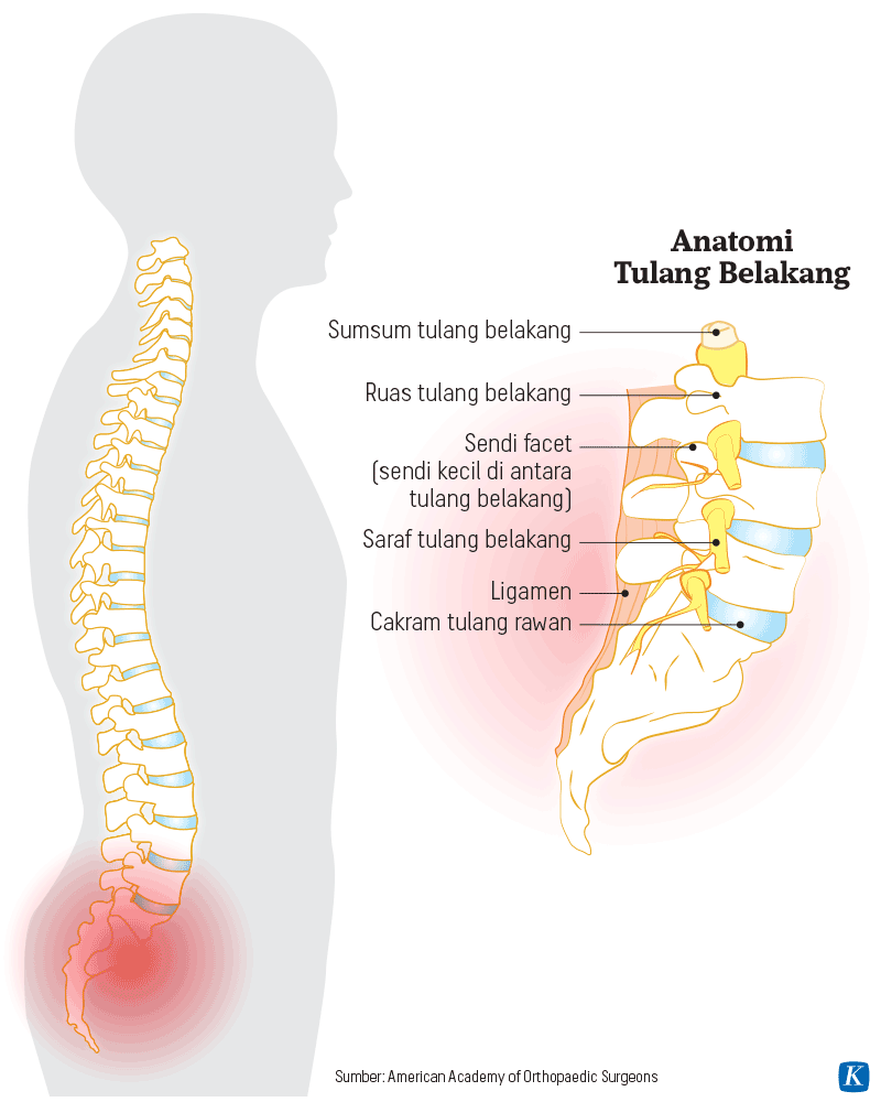 Alat Koreksi Kifosis Tulang Belakang - Kompas.id